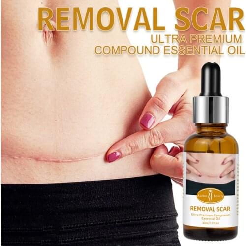 30ML Scar Removal Essence Oil Scar Repair Essential Oil Natural Plant Extracts Remove Ance Burn Strentch Marks SPA Massage Serum