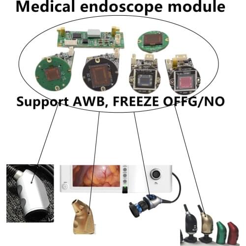 Full HD 1080P 60FPS CMOS Medical Endoscopic Camera Module IMX290 1080P@60Fps 50Fps Camera Broadcast Security Medical Industrial