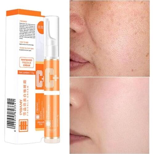 Beauty Face Cream Freckle Repair Blemish Cream Freckle Cream Remove Dark Spots Anti Aging Anti Wrinkle Lotion Essence Skin Care