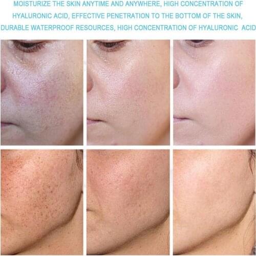 Effective Whitening Cream Freckle Remove Melasma Acne Moisturizing Dark Spots Pigment Spot Melanin Skin Gel Pigmentation Ca D1P2
