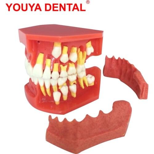 Dental Model Resin Children Primary Permanent Tooth Model Alternative Deciduous Teeth Model For Studying Teaching Demonstration