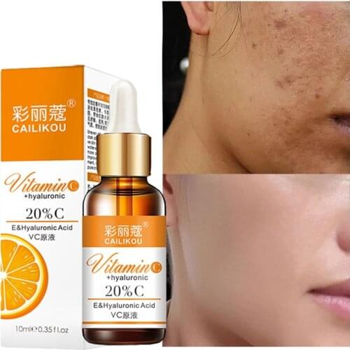 Vitamin C Whitening Face Serum Lighten Spots Brightening Facial Skin Essence Fade Dark Spots Remove Freckle Speckle Care