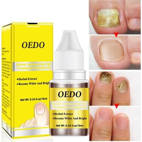Oedo herbal Antibacterial Nail Treatments Essential Oil Herbal Extract Nail Fungus Art Repair Tools Foot Nail Care Improve Infec
