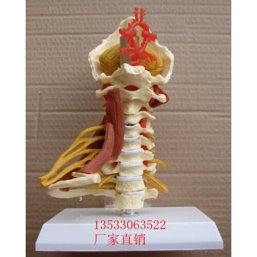 Cervical band nerve Musculoskeletal model Medical teaching model free shipping