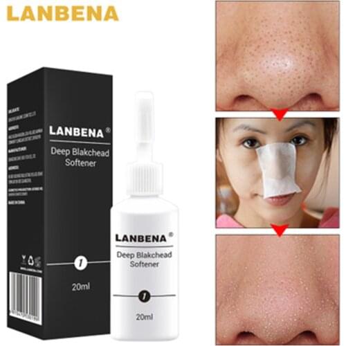 LANBENA Deep Blackhead Softener Blackhead Derived Liquid 20ML Nose Black Head Remover Acne Treatment Deep Cleansing Face Serum