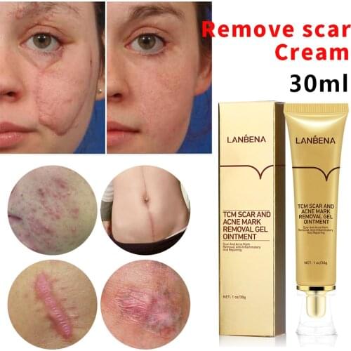 LANBENA Acne Scar Removal Cream Skin Repair Face Cream Acne Spots Acne Treatment Blackhead Whitening Cream Stretch Marks 30ml
