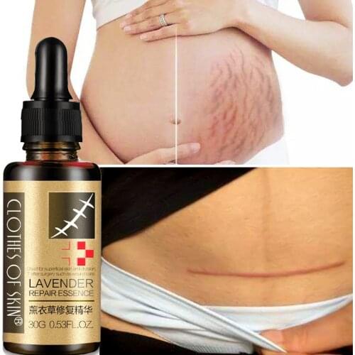 30ML Essential Massage oils Scar Removal Lavender Oil For Pregnant Women Hyaluronic Acid Serum Oil Essential Face Anti Acne