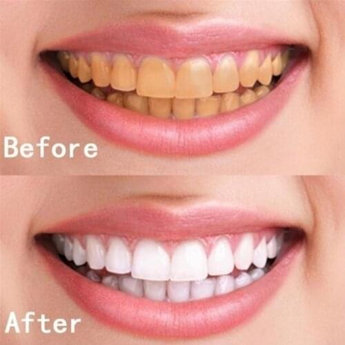 LANBENA Black Toothpastes