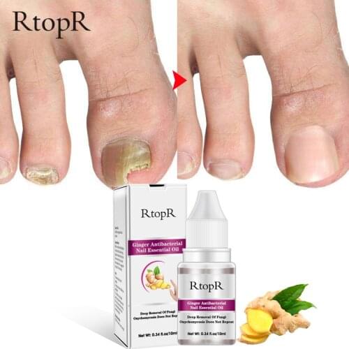 Fungal Nail Repair Essence Serum Care Treatment Foot Nail Fungus Removal Gel Anti Infection Paronychia Finger Toe Care TXTB1