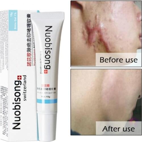15g Whitening Repair Remover Scar Stretch Acne Cream Birth Mark Face & Treatment Stretch Marks Burn Skin Care TSLM2