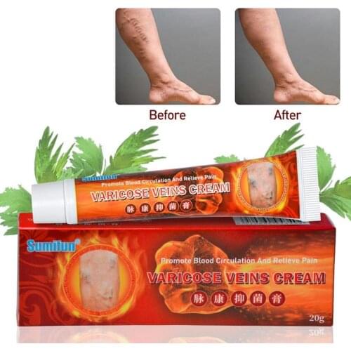 Varicose Veins Cream Chinese Medicine Herbal Anti Bacteria Psoriasis Eczema Treatment Ointment Relief Leg Phlebitis Pain Plaster