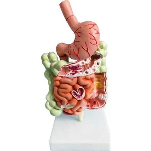 Human digestive system stomach anatomy large intestine cecum rectum duodenum human internal organs structure medical model