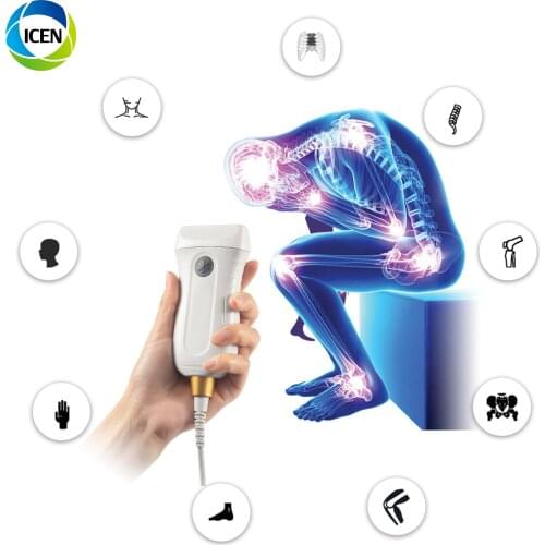 IN-AMX5 China Portable Medical Equipment Color Doppler Usb Ultrasound Probe Price For Laptop