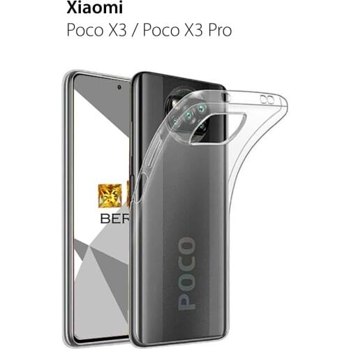 Berillos Xiaomi Poco X3 Phone Cases