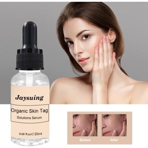 Mole And Skin Tag Remover Lotion Traceless Skin Repair Lotion Organic Tags Solutions Serum For Remove Moles And Skin Tags