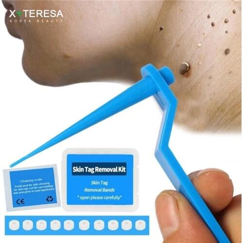 1Set Skin Tag Kill Skin Mole Wart Remover Micro Skin Tag Removal Kit With Cleansing Swabs Adult Mole Wart Face Care