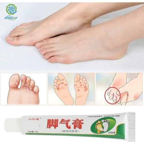 3 Boxes Beriberi Curing Cream Foot Care Chinese Herbal Patch Anti Fungal Infection Feet Repair Athletes Foot Treatment Cream
