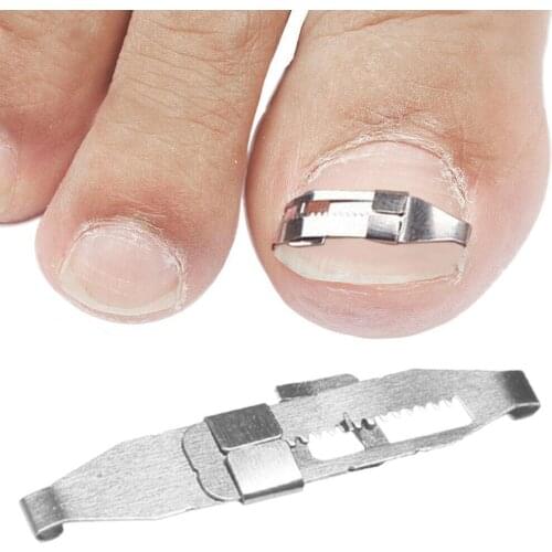 1 Pair New Toe Nail Fixer Toenail Correction Treatment Lifter Pedicure Recover Embed Tool Foot Care