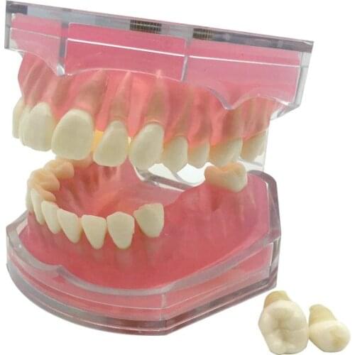 1Pc Dental Standard Model Removable Teeth Model Dentist Study Teach Model 7008# Dental Display Tool