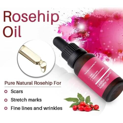 Mummys Joey Essential Oils