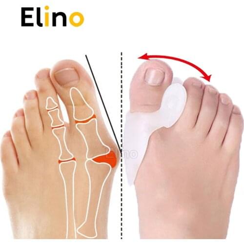 Soft Silicone Toe Separator for Hallux Valgus Orthosis Correction Overlapping Spreader Bunion Splint Foot Protector Inserts