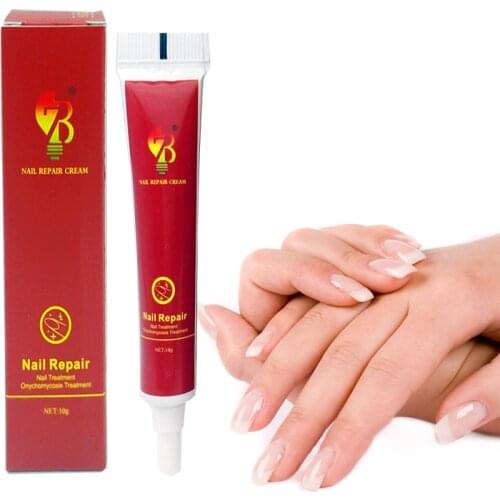 Best Fungus Nail Treatment Cream Onychomycosis Paronychia Anti Fungal Nail Infection Fights Bacteria And Fungus Naturally