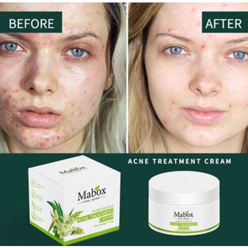 Hot Sell MABOX 20g Plant Acne Treatment Cream Essence Cream Makeup Skin Care Facial Care Korea Whiting Cream