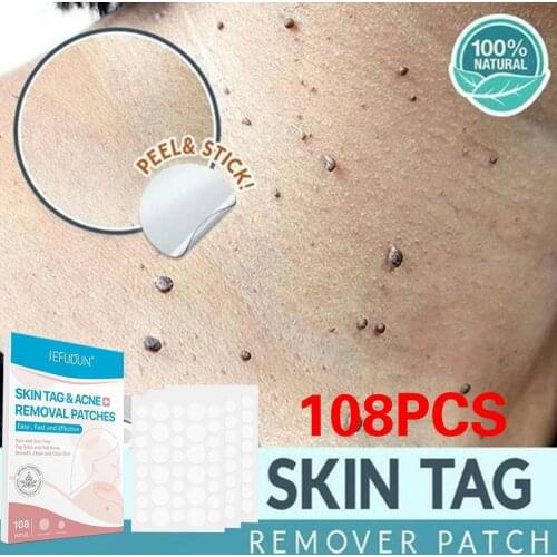 108pcs / lot Acne Remover Patches Wart Remover Skin Tag Remover Wart Stickers Beauty Acne Pimple Removal Skin Tag Skin Body Care