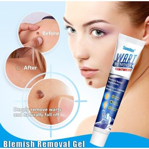 Warts Remover Antibacterial Ointment Wart Treatment Cream Skin Tag Remover Herbal Extract Corn Plaster Warts Ointment