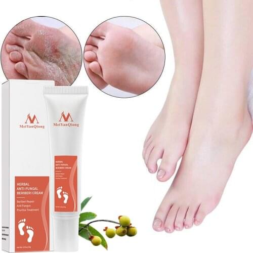 2019 Feet Repair Relieve Beriberi Treatment Foot Treatment Products Remove Foot Dryness Anti Fungal Infection
