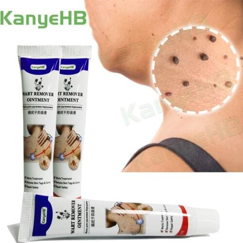 3pcs Warts Remover Antibacterial Ointment Wart Treatment Cream Skin Tag Remover Herbal Extract Corn Plaster Warts Ointment A635