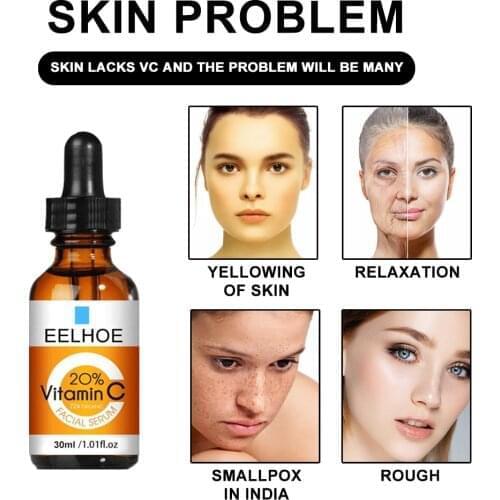 Minch 20% Vitamin C Essence Oil Anti Dark Spots Cover Ultra Brightening Spotless Essential Oil Anti-age Face Care 10/20/30ML