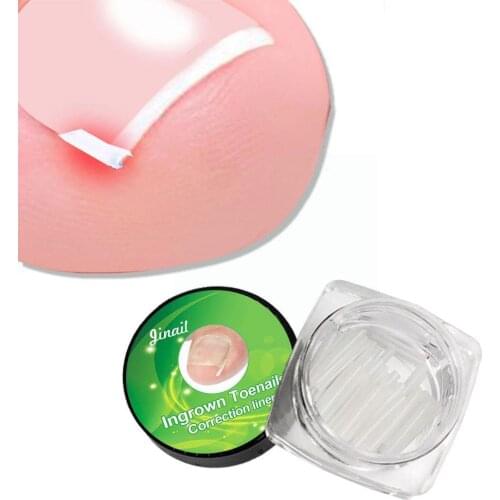 1PC Ingrown Toe Nail Recover Tool Pedicure Toenail Nail Care Foot For Toes Fixer Ingrowing Pedicure Nail Corrector Bunion S9W3