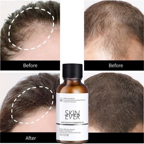 Centella Toner Centella Repair Essence Hair Care Solutions Gentle Hydrating Long Lasting Repair Smooth for Face Hair SK88