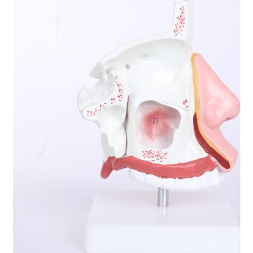 BIX-A1051 The Nasal Anatomy Model WBW347