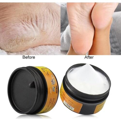 Effective Feet Cream Heel Cream 30g Anti-Drying Crack Repair Cream Anti-chapping Peeling for Foot Skin Hand Care Cream Pedicur
