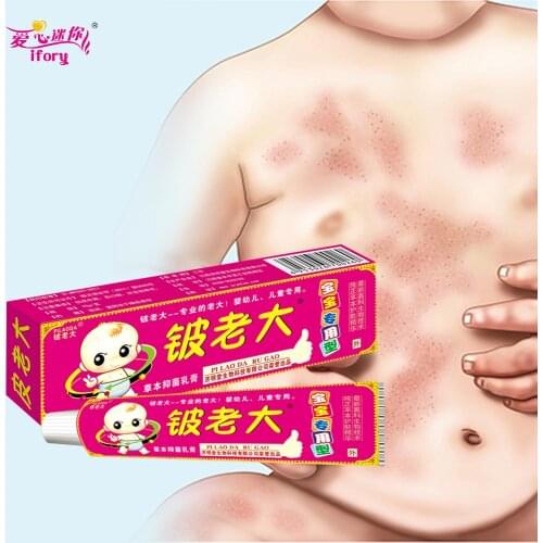 Ifory1Pcs Body Cream Chinese Patch Perfect For Dermatitis and Eczema Pruritus Herbal Cream 100% Safe Skin Care Cream Children