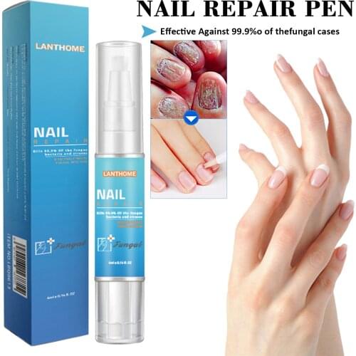 4ML Nail Treatment Pen Onychomycosis Paronychia Anti Fungal Nail Infection Chinese Herbal Toe Fungus Care Repair Serum