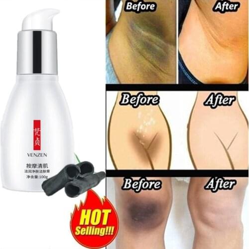 Whitening Cream Body Lotion Dark Spots Melasma Lightening Black Joints Knees Ankle Underarm Whitening For Axillary Private Parts
