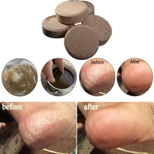 10 pcs Of Ginger Foot Effervescent Tablets Promote Metabolism Prevention Eliminate Fatigue Swelling Pain Foot Care Treatment