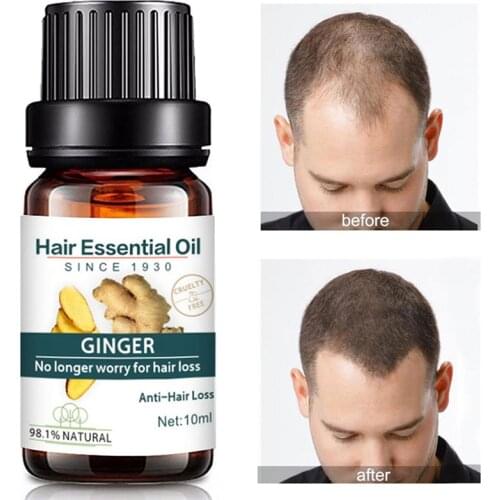 Ginger Plants Hair Growth Dense Essence Natural Pure Oil Hair Care Essential Oil Faster Grow Liquid 10ml Anti Hair Loss Products