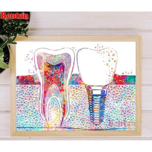 Dental implant dentist dental clinic diamond painting full square drill mosaic puzzle picture of rhinestones kits wall painting