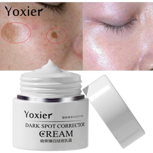 Dark Spot Correction Cream Remove Spots Body Pigmentation Face Cream Uneven Skin Tone Whitening Brightening Skin Care 30g