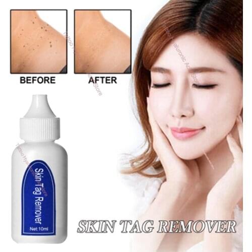 Skin Tag Remover Medical Against Moles 12 Hours Fast Removal Genital Wart Acne Spot Treatment Anti Foot Corn Skin Care Liquid
