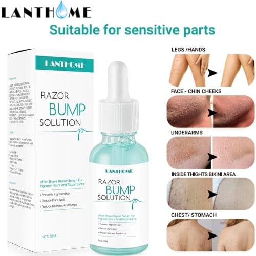LANTHOME 30ml Repair Serum After Hair Removal Prevent Ingrown Hairs and Razor Bump Body Treatment Smooth Skin Reduce Dark Spots