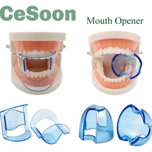 Dental Mouth Opener Autoclavable Lip Retractor Cheek Retractor Expander Anterior/Posterior Teeth Mouth Opener Oral Care Tool