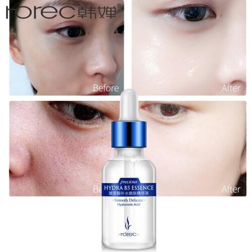 ROREC Hyaluronic Acid Moisturizier Serum Anti-Aging Skin Care Hydrating Skin Repair Face Cream Treatment Whitening Acne Pimples