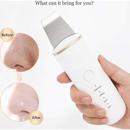 Ultrasonic Scrubber Deep Cleaning Cavitation Peeling Facial Peeling Ultrassonico Spatula Exfoliating Beauty Instrument Skin Care