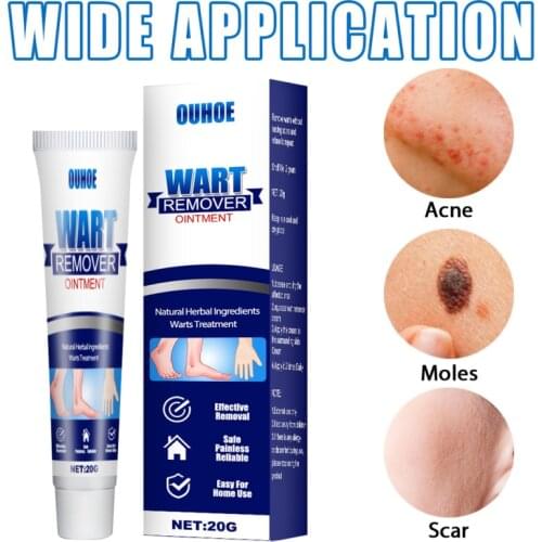 OUHOE 20g Warts Remover Cream Plantar Warts Herpes Acne Insect Bites Treatments Ointment Skin Tag Remover Antibacterial Salve