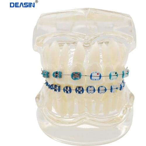 Dental Orthodontics Typodont Teeth Model Half Metal Half Ceramic Brace bracket Typodont with Arch Wire